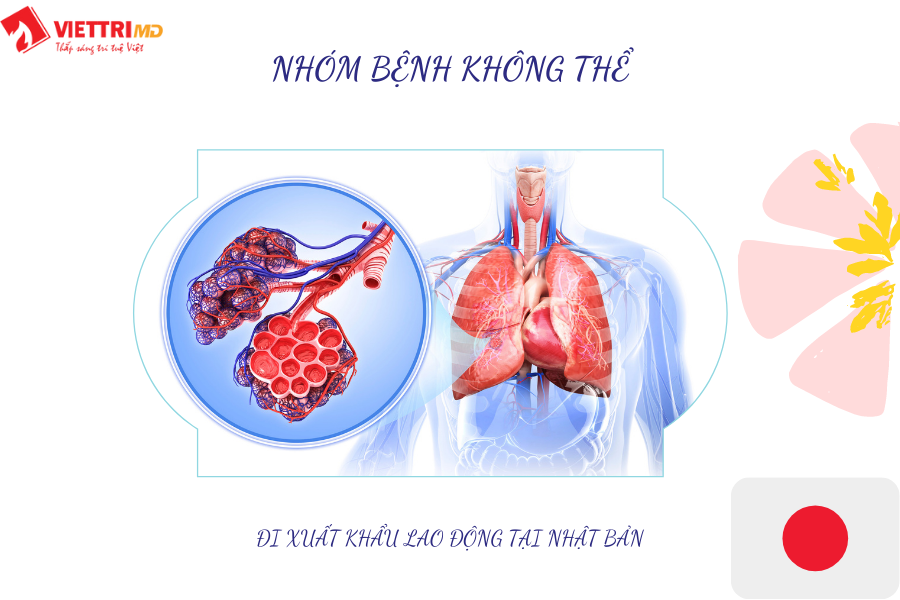 Bệnh đường hô hấp không thể đi xklđ Nhật