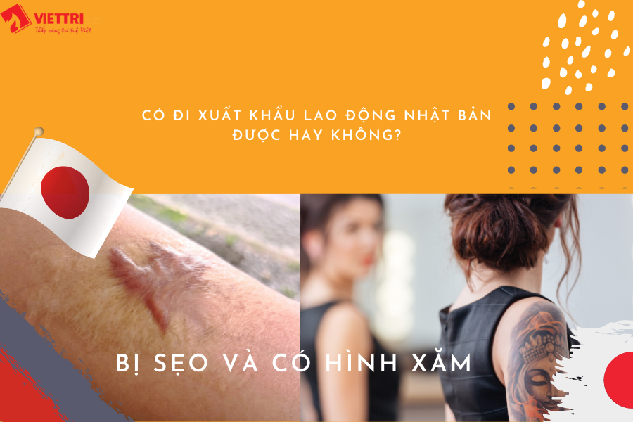 Bị sẹo và có hình xăm đi xklđ Nhật